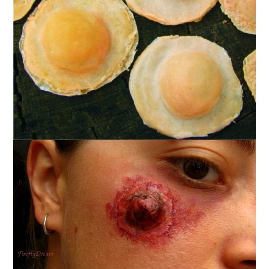Proteza latex pustula-REPT